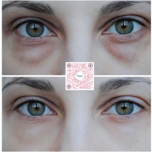 Teana Eye Contour 3