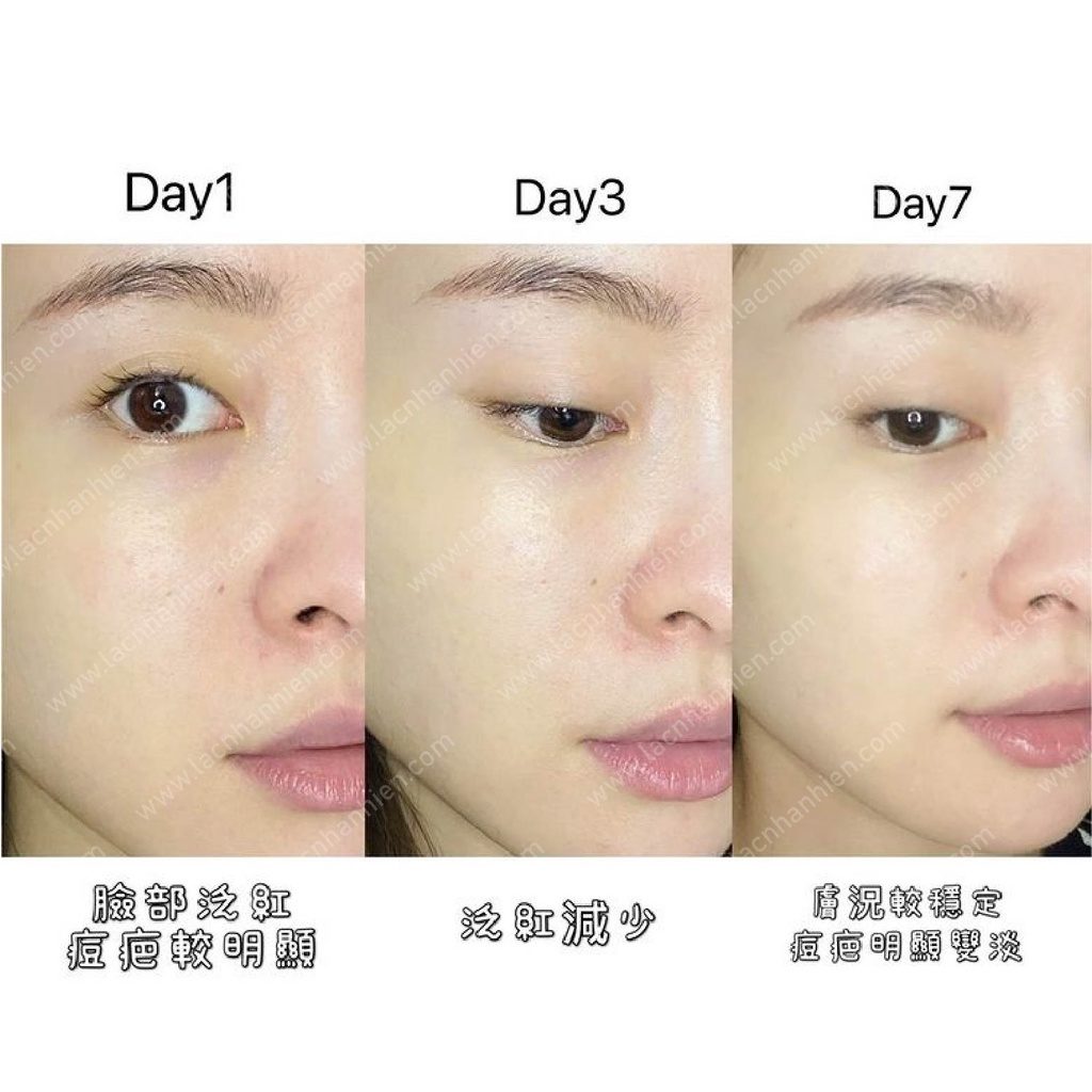 dr-wu-intensive-repairing-serum